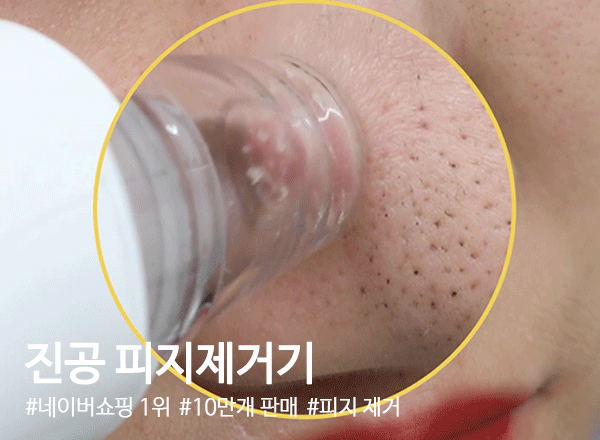 진공피지제거기